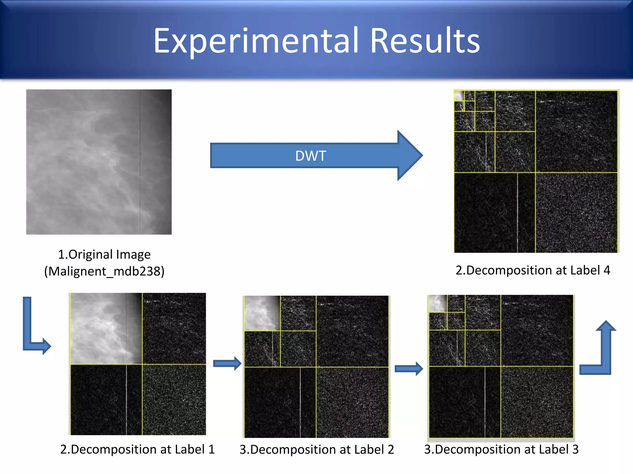 Experimental Results
DWT
1.Original Image
(Malignent_mdb238) 2.Decomposition at Label 4
2.Decomposition at Label 1 3.Decomposition at Label 2 3.Decomposition at Label 3
 