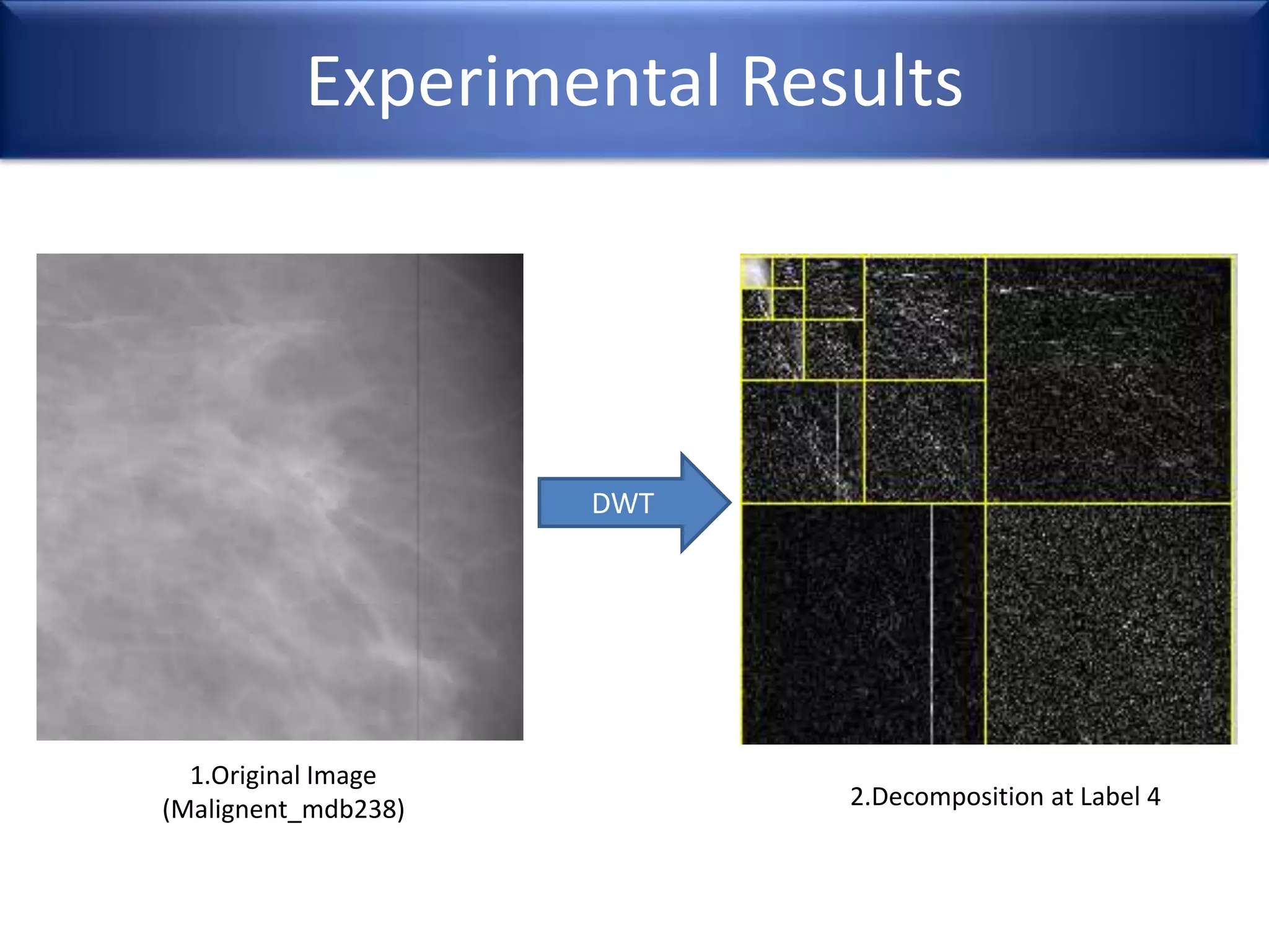 Experimental Results
DWT
1.Original Image
(Malignent_mdb238) 2.Decomposition at Label 4
 