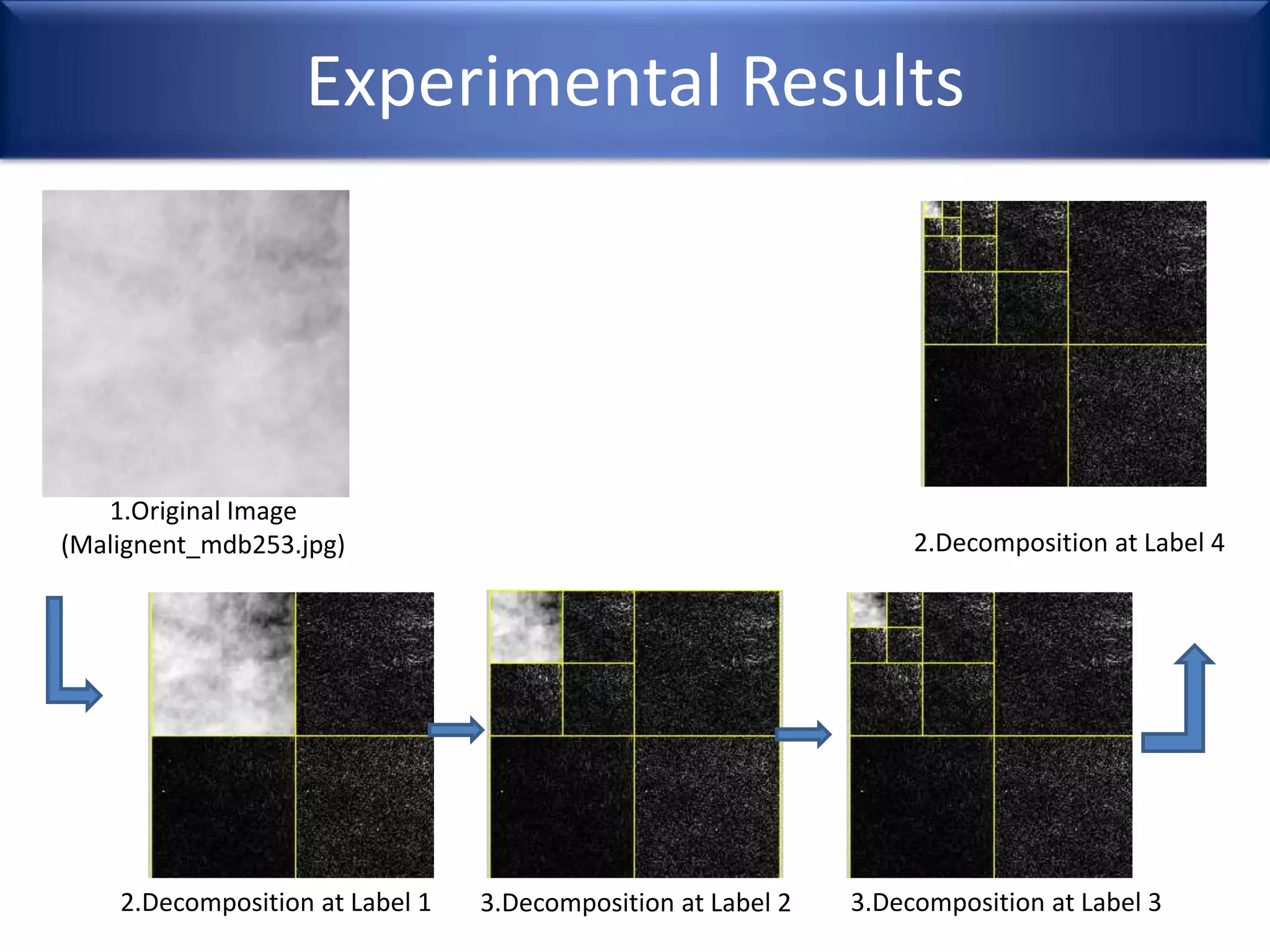 Experimental Results
1.Original Image
(Malignent_mdb253.jpg) 2.Decomposition at Label 4
2.Decomposition at Label 1 3.Decomposition at Label 2 3.Decomposition at Label 3
 