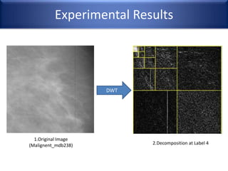 Experimental Results
DWT
1.Original Image
(Malignent_mdb238) 2.Decomposition at Label 4
 