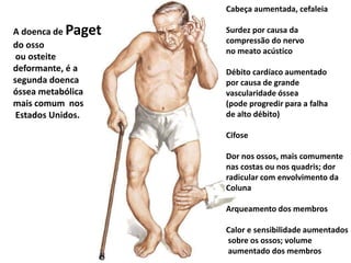 A doenca de Paget
do osso
ou osteite
deformante, é a
segunda doenca
óssea metabólica
mais comum nos
Estados Unidos.
Cabeça aumentada, cefaleia
Surdez por causa da
compressão do nervo
no meato acústico
Débito cardíaco aumentado
por causa de grande
vascularidade óssea
(pode progredir para a falha
de alto débito)
Cifose
Dor nos ossos, mais comumente
nas costas ou nos quadris; dor
radicular com envolvimento da
Coluna
Arqueamento dos membros
Calor e sensibilidade aumentados
sobre os ossos; volume
aumentado dos membros
 
