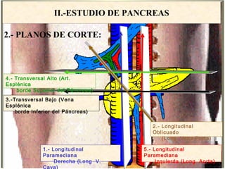 ECOGRAFIA ABDOMINAL - CORTES
II.-ESTUDIO DE PANCREAS
2.- Longitudinal
Oblicuado
(Long. Vena Porta)
5.- Longitudinal
Paramediana
Izquierda (Long Aorta)
1.- Longitudinal
Paramediana
Derecha (Long V.
Cava)
3.-Transversal Bajo (Vena
Esplénica
borde Inferior del Páncreas)
4.- Transversal Alto (Art.
Esplénica
borde Superior del Páncreas)
2.- PLANOS DE CORTE:
 