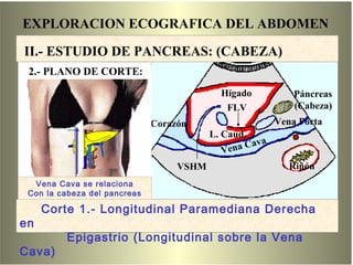 EXPLORACION ECOGRAFICA DEL ABDOMEN
Hígado Páncreas
(Cabeza)
Corazón
Riñón
Vena Porta
Vena Cava
L. Caud.
FLV
VSHM
II.- ESTUDIO DE PANCREAS: (CABEZA)
Corte 1
Corte 1.- Longitudinal Paramediana Derecha
en
Epigastrio (Longitudinal sobre la Vena
Cava)
Vena Cava se relaciona
Con la cabeza del pancreas
2.- PLANO DE CORTE:
 