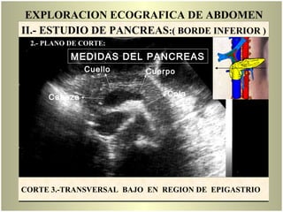 EXPLORACION ECOGRAFICA DE ABDOMEN
Cabeza
Cuello Cuerpo
Cola
CORTE 3.-TRANSVERSAL BAJO EN REGION DE EPIGASTRIO
MEDIDAS DEL PANCREAS
II.- ESTUDIO DE PANCREAS:( BORDE INFERIOR )
2.- PLANO DE CORTE:
 