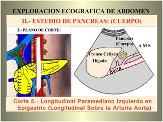 EXPLORACION ECOGRAFICA DE ABDOMEN
Hígado
Páncreas
(Cuerpo)
Aorta
A M S
Tronco Celiaco
Corte 5
Corte 5.- Longitudinal Paramediano Izquierdo en
Epigastrio (Longitudinal Sobre la Arteria Aorta)
2.- PLANO DE CORTE:
II.- ESTUDIO DE PANCREAS: (CUERPO)
2.- PLANO DE CORTE:
 