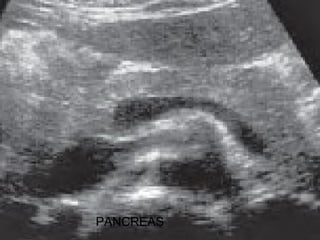 PANCREAS
 