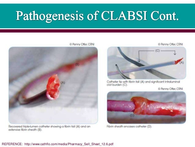 3. central line associated blood stream infection