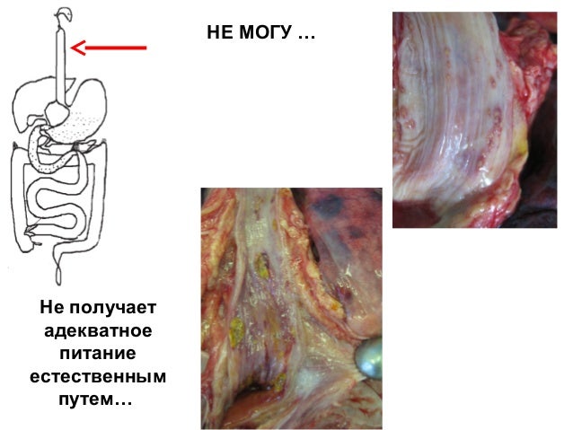 Парентеральное И Энтеральное Питание Национальное Руководство