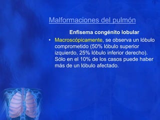 Lobulo Infectado 3. anatomía patológica del aparato respiratorio 1 | PPTX