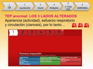 TEP anormal: LOS 3 LADOS ALTERADOS
Apariencia (actividad), esfuerzo respiratorio
y circulación (cianosis), por lo tanto…
 