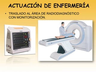 ACTUACIÓN DE ENFERMERÍA
• TRASLADO AL ÁREA DE RADIODIAGNÓSTICO
CON MONITORIZACIÓN.
 