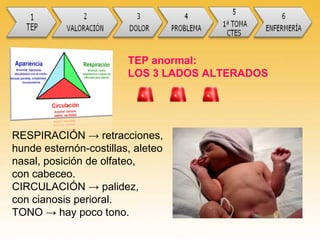 RESPIRACIÓN → retracciones,
hunde esternón-costillas, aleteo
nasal, posición de olfateo,
con cabeceo.
CIRCULACIÓN → palidez,
con cianosis perioral.
TONO → hay poco tono.
TEP anormal:
LOS 3 LADOS ALTERADOS
 