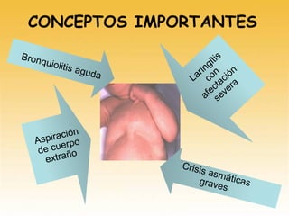 CONCEPTOS IMPORTANTES
 