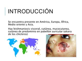 INTRODUCCIÓN
Se encuentra presente en América, Europa, África,
Medio oriente y Asia.
Hay leishmaniosis visceral, cutánea, mucocutanea,
cutánea de predominio en pabellón auricular (ulcera
de los chicleros)
