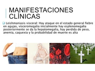 MANIFESTACIONES
CLÍNICAS
Leishmaniasis visceral: Hay ataque en el estado general fiebre
en agujas, visceromegalia inicialmente hay esplenomegalia
posteriormente se da la hepatomegalia, hay perdida de peso,
anemia, caquexia y la probabilidad de muerte es alta