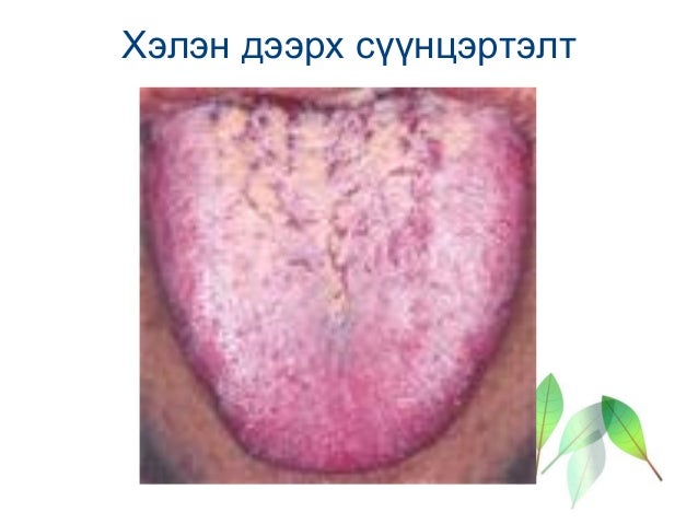 бие даалт №3 салст