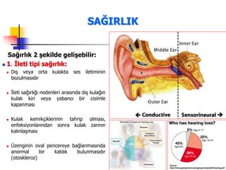 50
SAĞIRLIK
Sağırlık 2 şekilde gelişebilir:
 1. İleti tipi sağırlık:
 Dış veya orta kulakta ses iletiminin
bozulmasıdır
 İleti sağırlığı nedenleri arasında dış kulağın
kulak kiri veya yabancı bir cisimle
kapanması
 Kulak kemikçiklerinin tahrip olması,
enfeksiyonlarından sonra kulak zarının
kalınlaşması
 Üzenginin oval pencereye bağlanmasında
anormal bir katılık bulunmasıdır
(otoskleroz)
 
