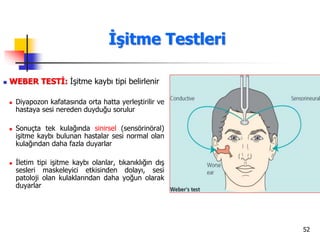 52
 WEBER TESTİ: İşitme kaybı tipi belirlenir
 Diyapozon kafatasında orta hatta yerleştirilir ve
hastaya sesi nereden duyduğu sorulur
 Sonuçta tek kulağında sinirsel (sensörinöral)
işitme kaybı bulunan hastalar sesi normal olan
kulağından daha fazla duyarlar
 İletim tipi işitme kaybı olanlar, tıkanıklığın dış
sesleri maskeleyici etkisinden dolayı, sesi
patoloji olan kulaklarından daha yoğun olarak
duyarlar
İşitme Testleri
 