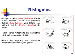 60
Nistagmus
 Nistagmus sıklıkla yatay (horizontal) ise de
dönüş sırasında kafanın yana yatırılması
halinde dikey (vertical) veya kafanın öne
eğilmesi halinde döngüsel (sirküler) de
olabilir
 Tanım olarak nistagmusta göz hareketinin
yönü hızlı kompenentin yönüdür
 Klinikte beyin sapı lezyonları bulunanlarda
dinlenme sırasında nistagmus görülür
 