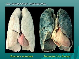Une comparaison intéressante…Une comparaison intéressante…
Poumons d’un fumeurPoumons d’un fumeurPoumons normauxPoumons normaux
 
