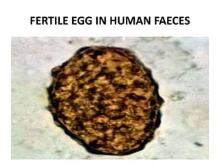 FERTILE EGG IN HUMAN FAECES
 