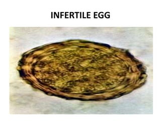 INFERTILE EGG
 