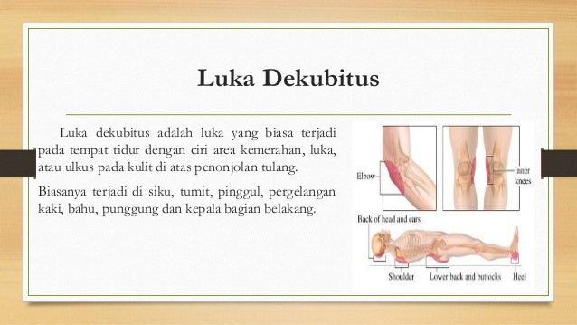 Konsep Perawatan Luka Dekubitus dan Gangrene