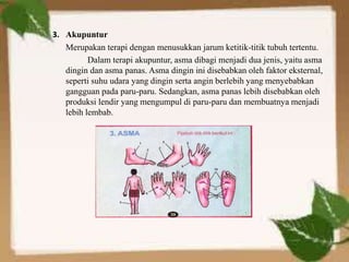 3. Akupuntur
Merupakan terapi dengan menusukkan jarum ketitik-titik tubuh tertentu.
Dalam terapi akupuntur, asma dibagi menjadi dua jenis, yaitu asma
dingin dan asma panas. Asma dingin ini disebabkan oleh faktor eksternal,
seperti suhu udara yang dingin serta angin berlebih yang menyebabkan
gangguan pada paru-paru. Sedangkan, asma panas lebih disebabkan oleh
produksi lendir yang mengumpul di paru-paru dan membuatnya menjadi
lebih lembab.
 