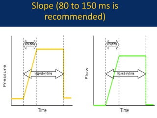 Slope (80 to 150 ms is
recommended)
June 1, 2016 13
 