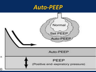 Auto-PEEP
June 1, 2016 32
 