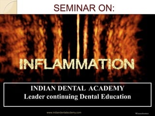 SEMINAR ON:

GUIDED BY: PRESENTED
BY:
 Dr. R. R. Bhowate Shruti Sood
 Prof and Guide

 D
INDIAN DENTAL ACADEMY
Leader continuing Dental Education
www.indiandentalacdemy.com
 
