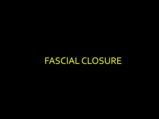 FASCIAL CLOSURE
 