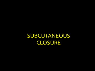 SUBCUTANEOUS
CLOSURE
 