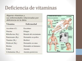Deficiencia de vitaminas
 