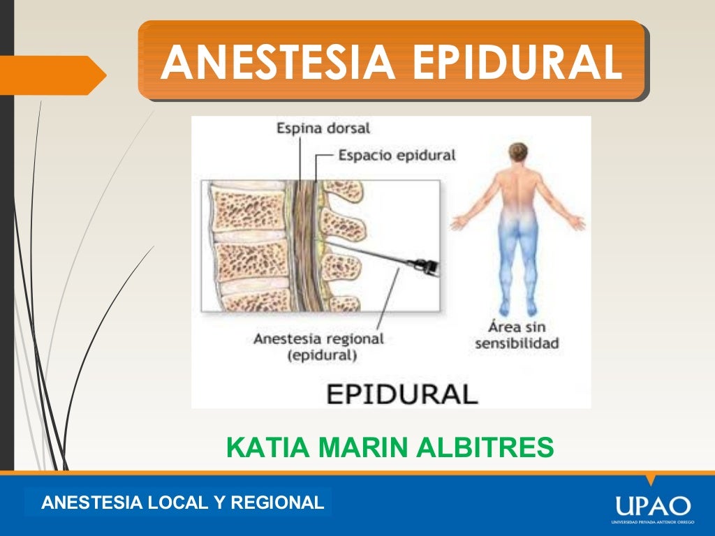 3.anestesia epidural