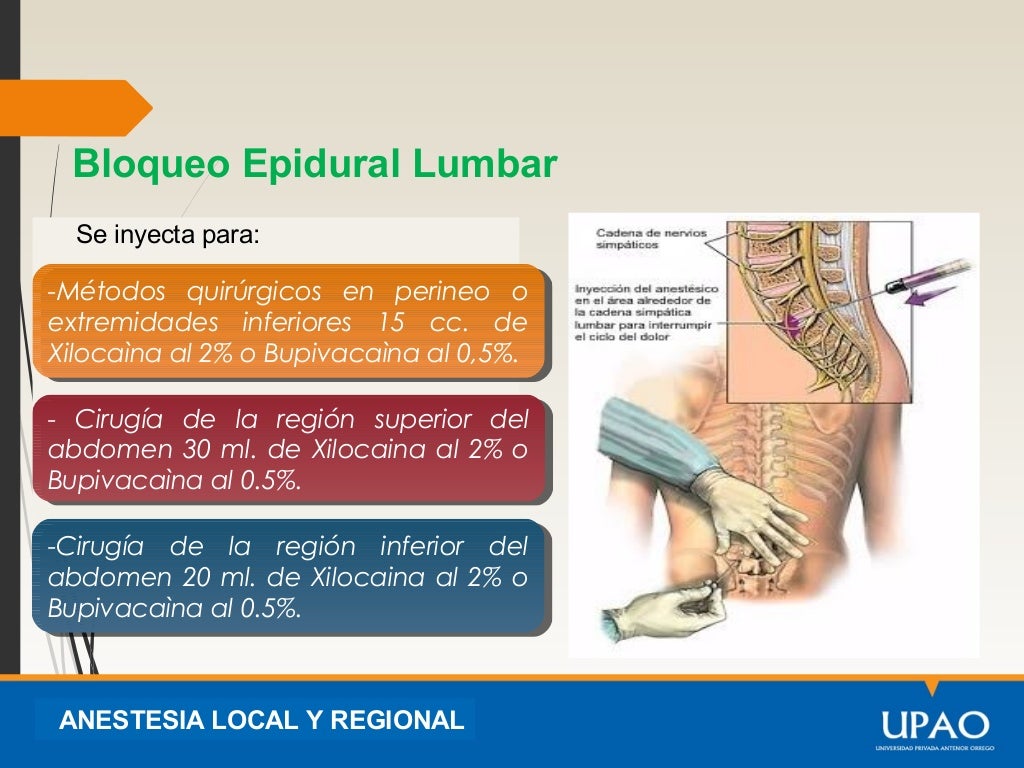 3.anestesia epidural
