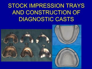 STOCK IMPRESSION TRAYS
AND CONSTRUCTION OF
DIAGNOSTIC CASTS
 