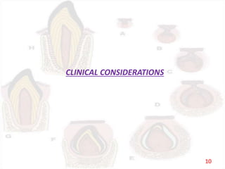 CLINICAL CONSIDERATIONS
10
 