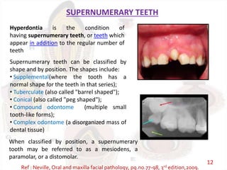 SUPERNUMERARY TEETH
Supernumerary teeth can be classified by
shape and by position. The shapes include:
• Supplemental(where the tooth has a
normal shape for the teeth in that series);
• Tuberculate (also called "barrel shaped");
• Conical (also called "peg shaped");
• Compound odontome (multiple small
tooth-like forms);
• Complex odontome (a disorganized mass of
dental tissue)
Hyperdontia is the condition of
having supernumerary teeth, or teeth which
appear in addition to the regular number of
teeth
When classified by position, a supernumerary
tooth may be referred to as a mesiodens, a
paramolar, or a distomolar.
Ref : Neville, Oral and maxilla facial pathology, pg.no.77-98, 3rd edition,2009.
12
 