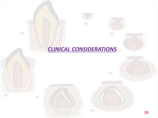 CLINICAL CONSIDERATIONS
39
 