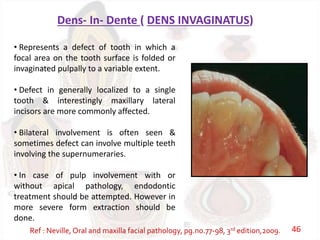 Dens- In- Dente ( DENS INVAGINATUS)
• Represents a defect of tooth in which a
focal area on the tooth surface is folded or
invaginated pulpally to a variable extent.
• Defect in generally localized to a single
tooth & interestingly maxillary lateral
incisors are more commonly affected.
• Bilateral involvement is often seen &
sometimes defect can involve multiple teeth
involving the supernumeraries.
• In case of pulp involvement with or
without apical pathology, endodontic
treatment should be attempted. However in
more severe form extraction should be
done.
Ref : Neville, Oral and maxilla facial pathology, pg.no.77-98, 3rd edition,2009. 46
 