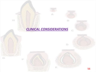 CLINICAL CONSIDERATIONS
56
 