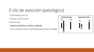 E clic de eyección (patológico)
- Protosistólico (tras S1)
-Cuando se abre la aorta
Puede ser por:
- Estenosis pulmonar o aórtica congénita
- No en estenosis aórtica calcificada porque valvas son rígidas
 