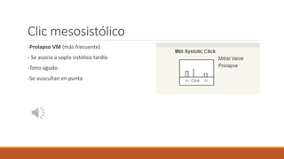 Clic mesosistólico
-Prolapso VM (más frecuente)
- Se asocia a soplo sistólico tardío
-Tono agudo
-Se auscultan en punta
 