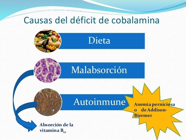 ANEMIA PERNICIOSA AUTOINMUNE PDF