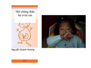 Hội chứng thận
hư ở trẻ em
Nguyễn Quỳnh Hương
 