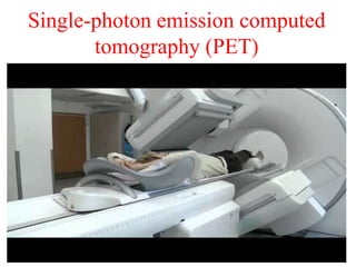Single-photon emission computed
tomography (PET)
 