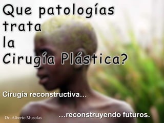 Que patologías
trata
la
Cirugía Plástica?
Dr. Alberto Musolas
Cirugía reconstructiva…
…reconstruyendo futuros.
 