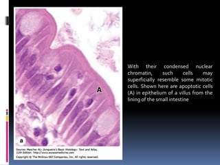 With their condensed nuclear
chromatin, such cells may
superficially resemble some mitotic
cells. Shown here are apoptotic cells
(A) in epithelium of a villus from the
lining of the small intestine
 