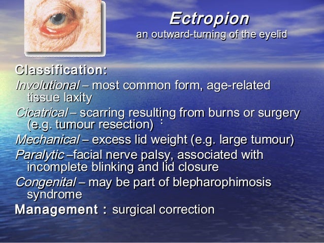 Diseases of Eyelids, Lacrymal system & Orbit